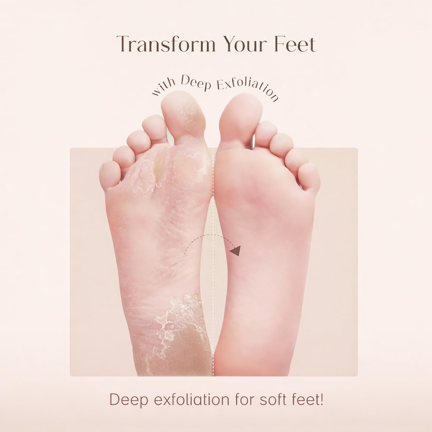 Signamio Foot Mask Peeling Feet Mask for Cracked Feet - Foot Peeling Mask Exfoliator - Callus Remover Foot Mask for Smooth, Soft Feet - Hydrating Foot Care Treatment - Goat Milk