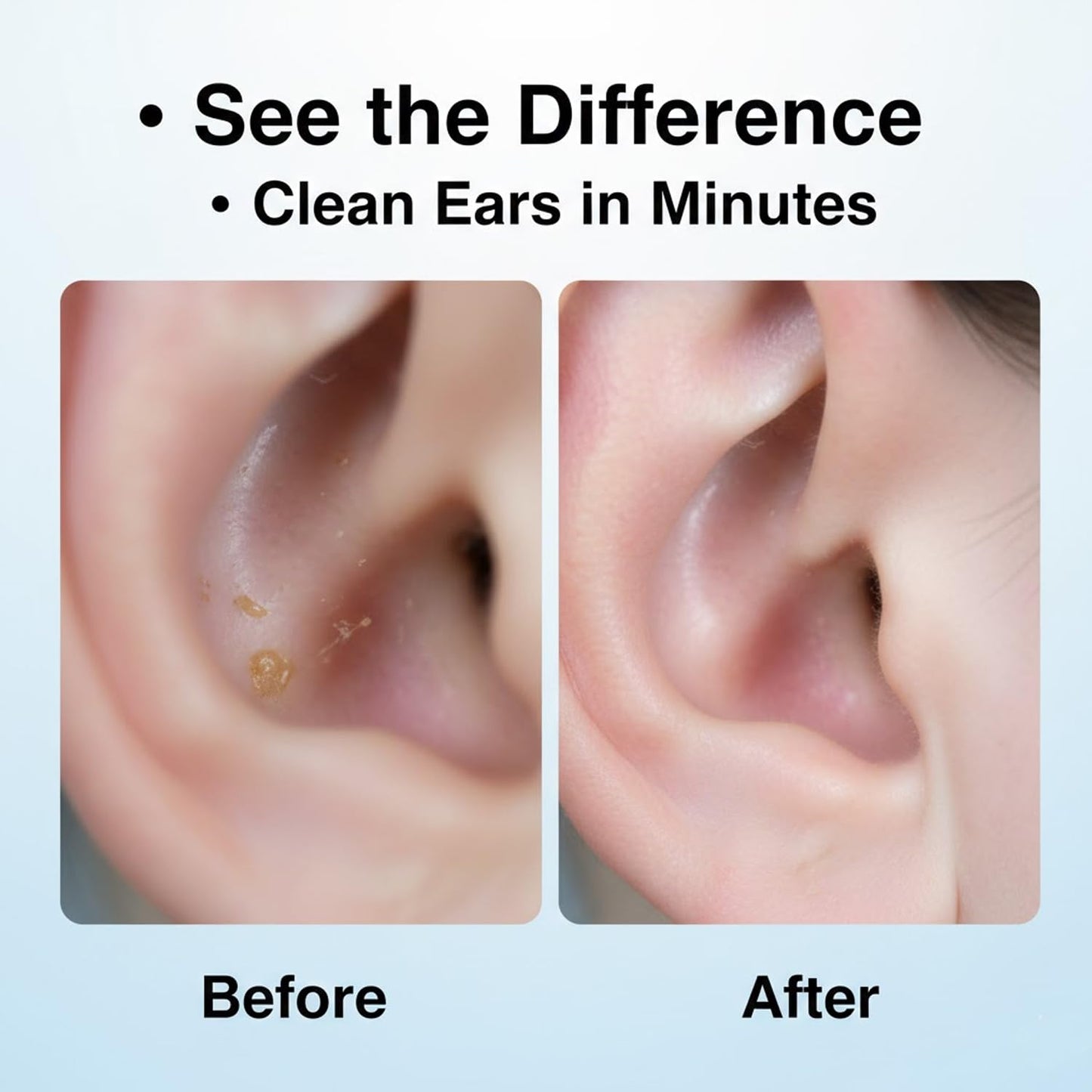 Signamio Ear Cleaner Tool with Camera - HD Ear Wax Removal Tool with WiFi Connection, LED Light Endoscope Ear Cleaning Tool Kit for Safe and Effective Cleaning